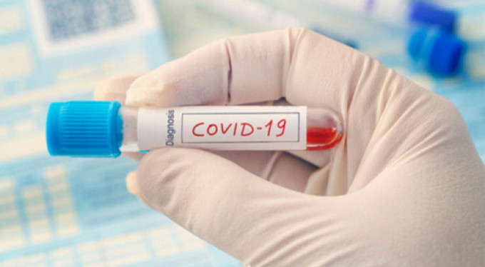 Türkiye'nin korona virüs bilançosu açıklandı!