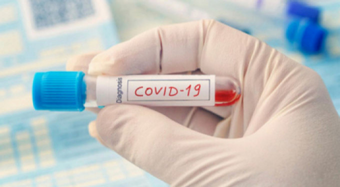 Bursa'da bir apartman daha karantinada!