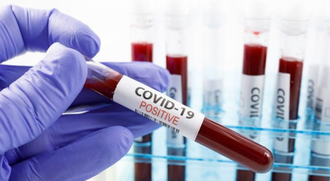 O kentte herkese test yapılacak!