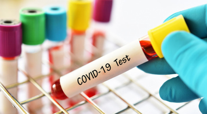 15 yaşındaki kız tüm akrabalarına bulaştırdı!