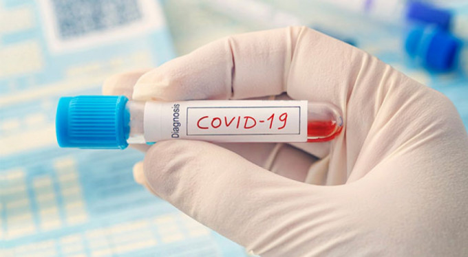 Covid-19 testleri ne zaman yapılmalı?