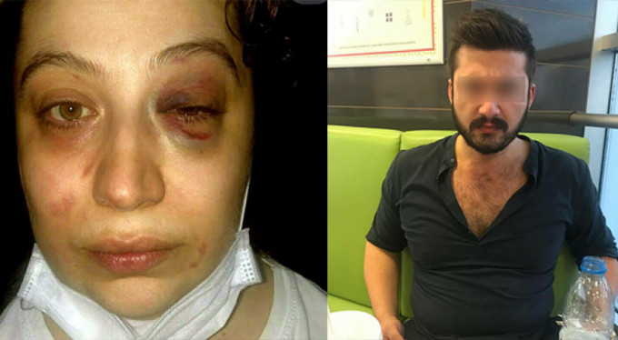 Bir kadının çığlığı! "Korkuyorum..."