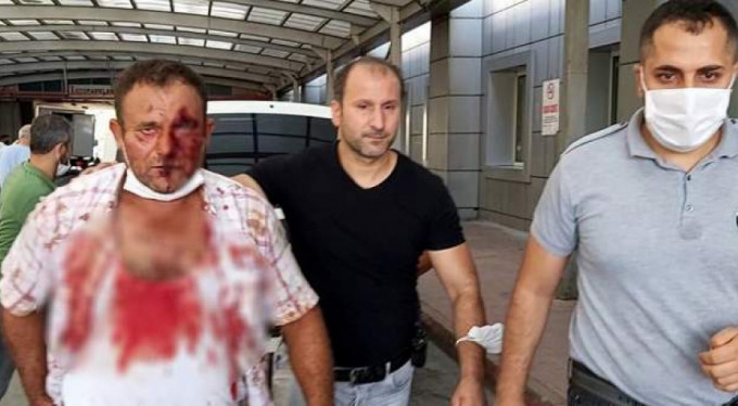 Baltayla saldırıya uğrayınca oğlunu öldürdü