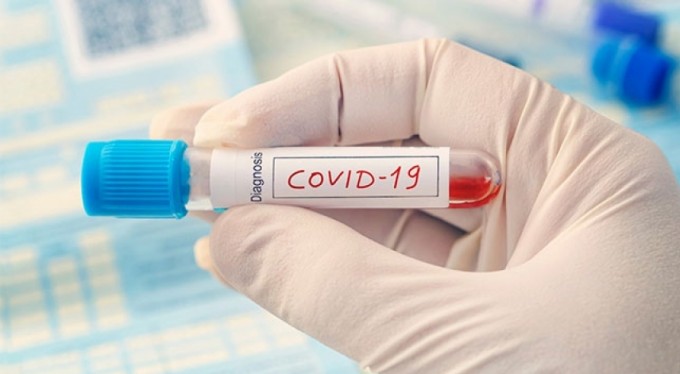 Haftalık harita açıklandı, Bursa'da vaka sayısı kaç ?