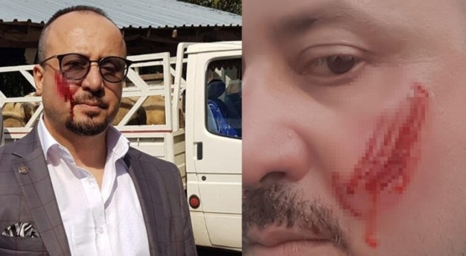 Avukatın yanağını ısıran anne ve oğluna hapis