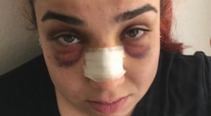 Gaddar patron, telefonla konuşan çalışanını dövdü