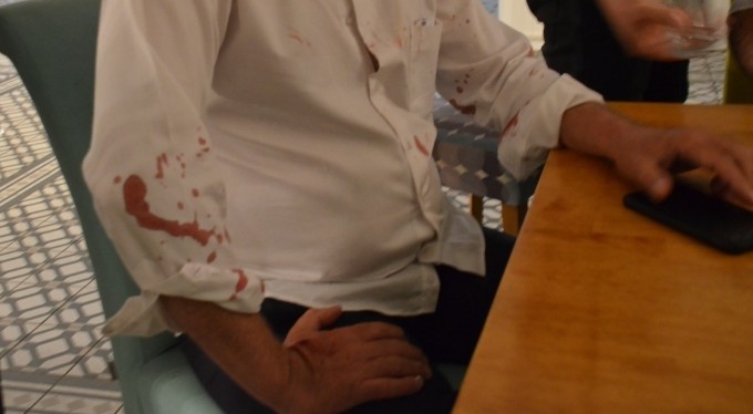 Belediye Başkanına beyzbol sopalı saldırı!