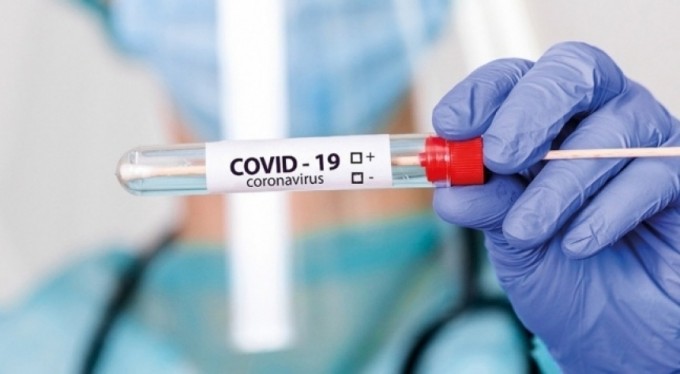 Moskova'da Covid-19 salgınında rekor can kaybı