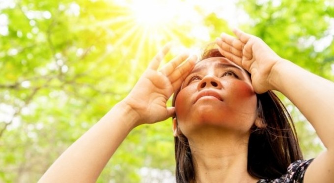 Güneşle gelen cilt lekelerine dikkat