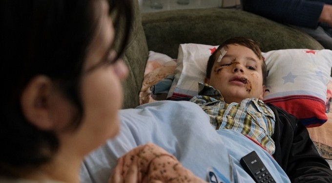 Sokak köpeğinin saldırısına uğrayan çocuk ölümden döndü