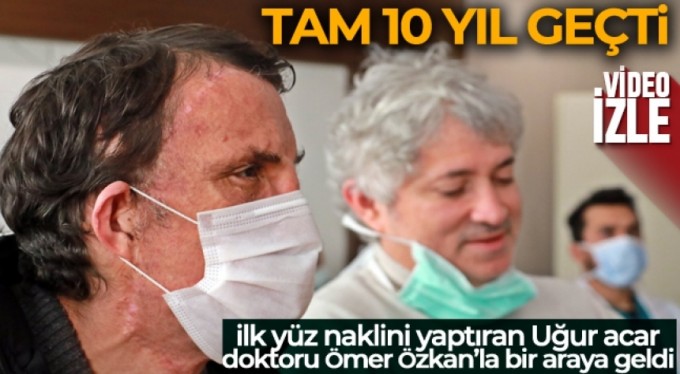 Türkiye'nin ilk yüz nakli 10 yaşında