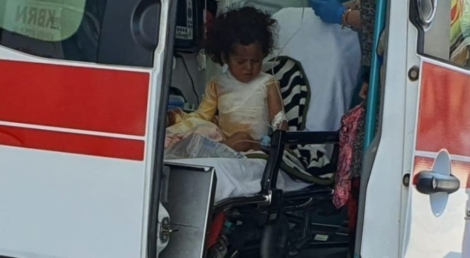 Üzerlerine kaynar su dökülen 2 kardeş yaralandı