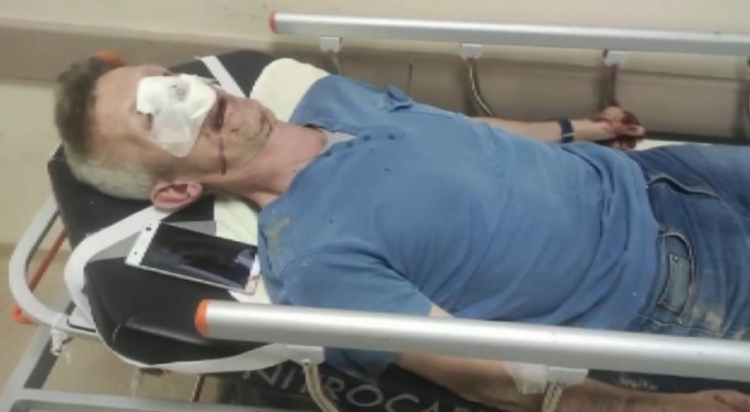 Sitedeki fahiş zam için eylem yaptı, yöneticiden dayak yedi