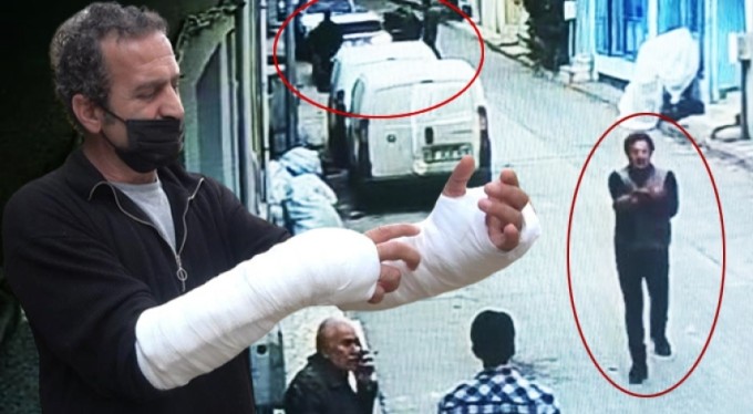 Bursa'da 'Pitbull' dehşeti! Kolları parçalandı, ölümden döndü