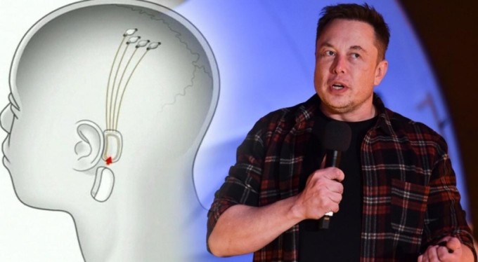 Elon Musk'ın şirketi gelecek yıl insanlara çip takmaya başlayacak