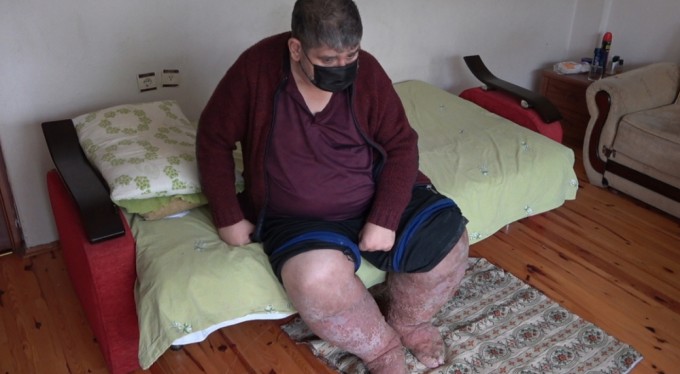 Sivrisinek, güvenlik görevlisinin hayatını kararttı