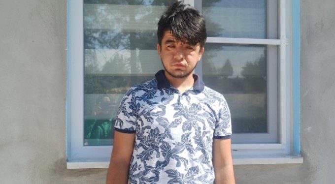 Dünyada nadir görülüyor yaşını duyan şaşkına dönüyor!