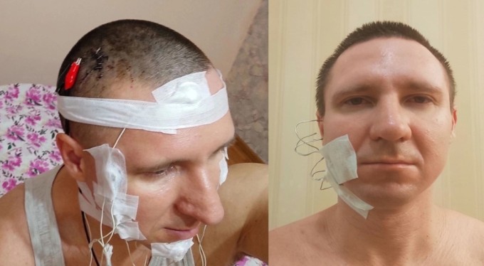 Yok artık dedirten olay! Rüyalarını kontrol edebilmek için kafasını...