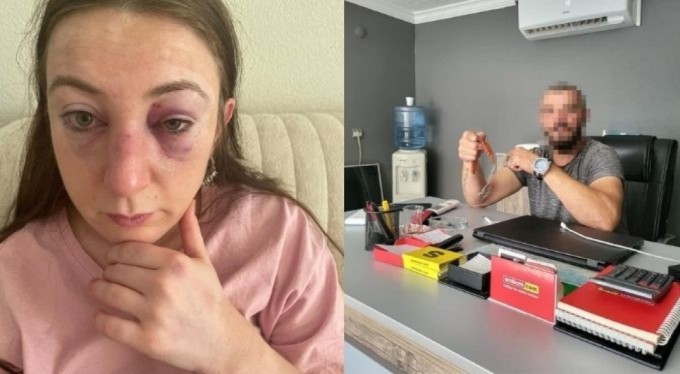 Bursa'da kadına şiddet! Eski erkek arkadaşı darp etti