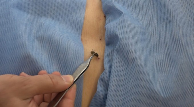 Bursa'da 5 bin yıllık tedavi: Bu arılar şifa dağıtıyor