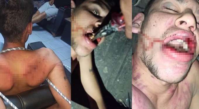 Korkunç Olay! İşkence yapıp böcek yedirdiler, kerpetenle dişlerini söktüler