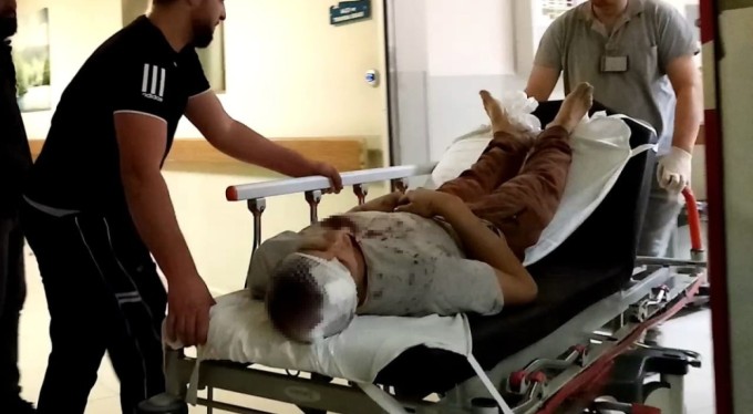 Kadınların kavgasına kocalar da karıştı: 1 yaralı