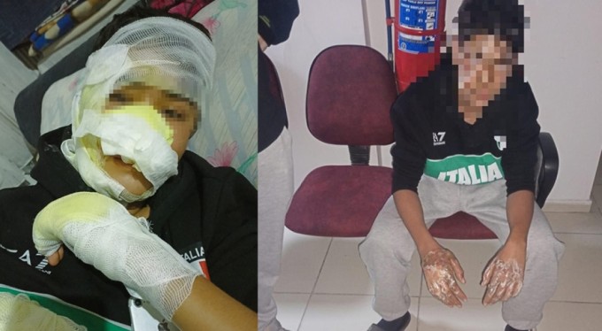 Önce fırına kilitlediler sonra dereceyi artırdılar