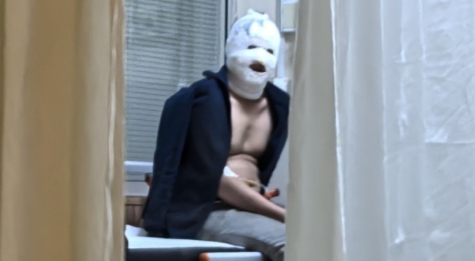 Benzinle soba tutuşturan genç yaralandı