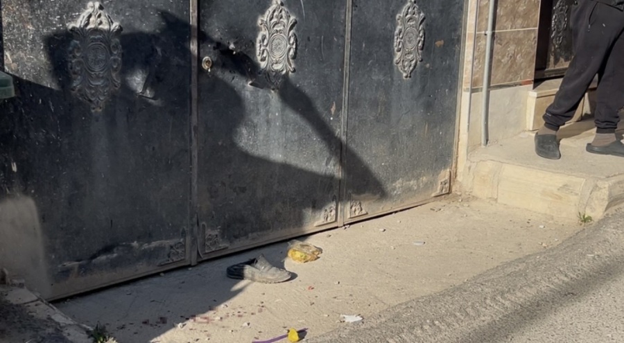 Bursa'da çöp atma kavgası: 1'i ağır 3 yaralı