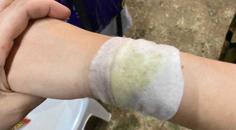 Bursa'da meşale 4 çocuğu yaktı