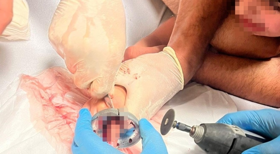 Bursa'da çocuğun parmağı çeşme aynasına sıkıştı