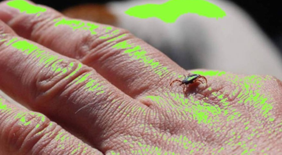 Kene kabusu devam ediyor, Sivas'ta keneden ölenlerin sayısı 12'ye yükseldi