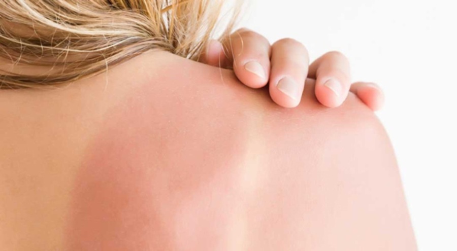 Güneş kremlerine dikkat! Cildi tam korumayabilir