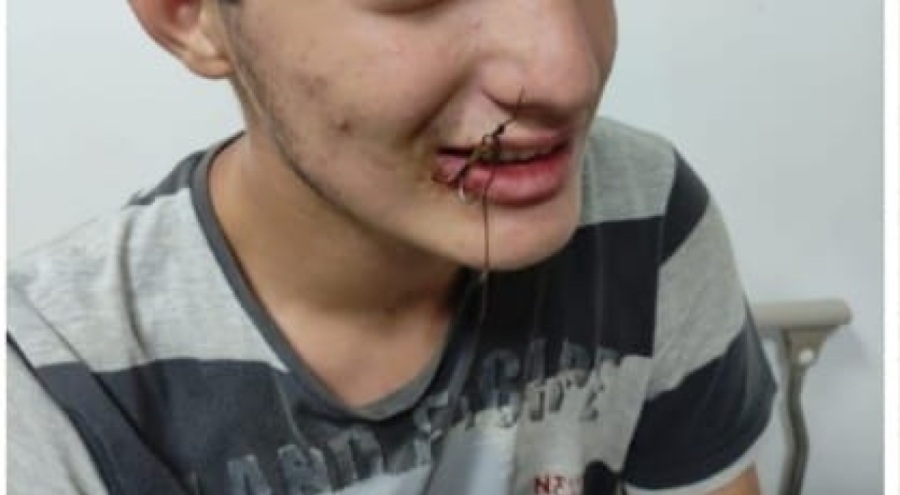 Bu kez oltaya çocuk takıldı