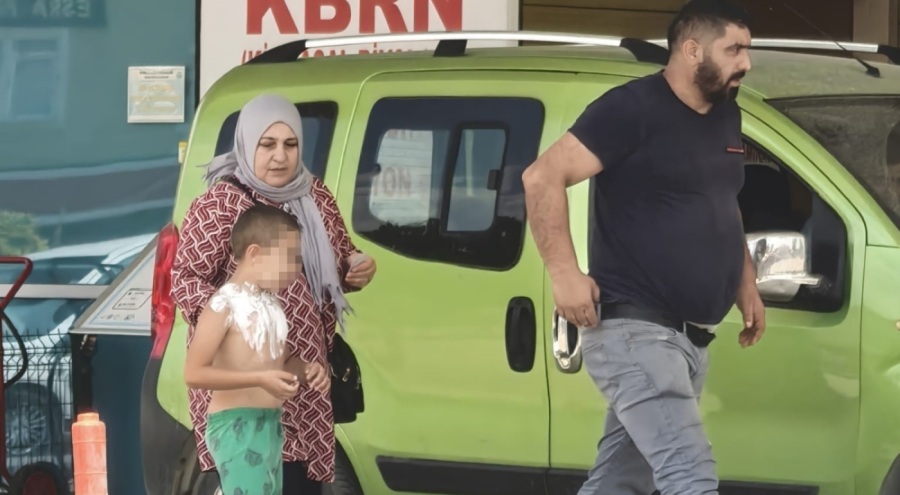Üzerine parfüm sıkıp çakmak yakan çocuk yaralandı