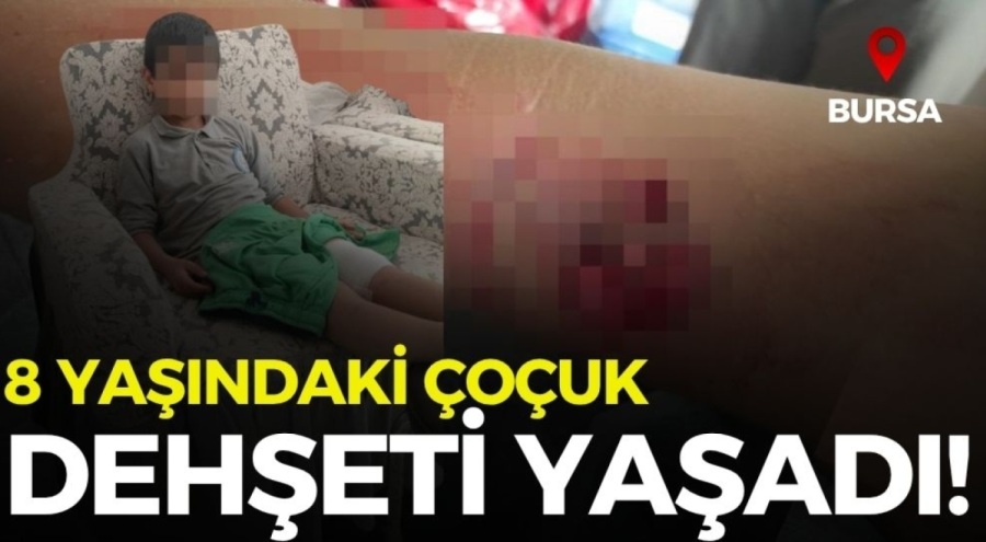 Bursa'da sokak köpeği saldırdı