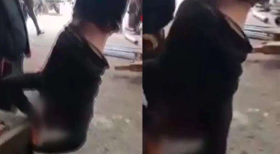 Ankara'da engelli işçiyi vince asan 4 kişi gözaltında