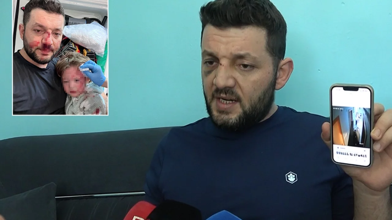 Scooter'la Saldırıya 36 Yıla Kadar Hapis İstemi