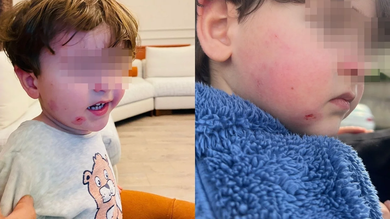 Bursa'da kreşte darp iddiası: 2,5 yaşındaki çocuk yaralı bulundu