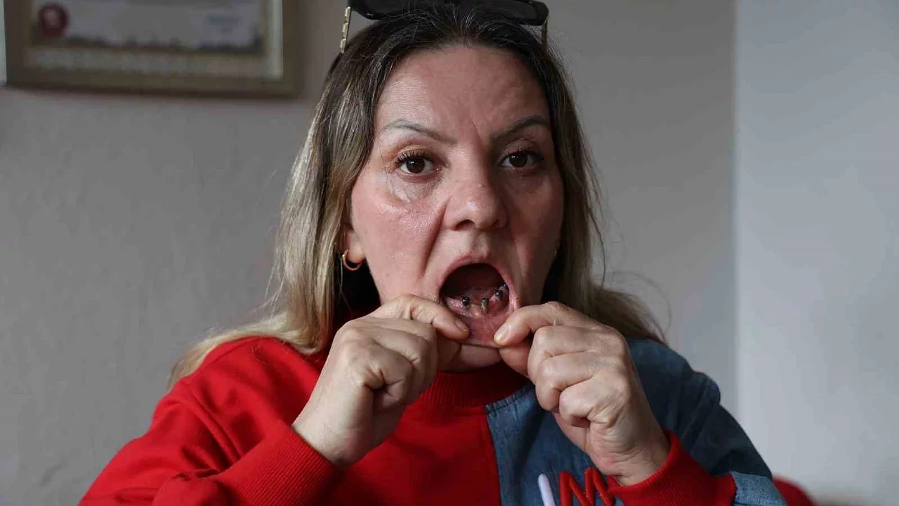 Diş ağrısıyla gitti, 25 dişi çekildi: Hayatı kabusa döndü