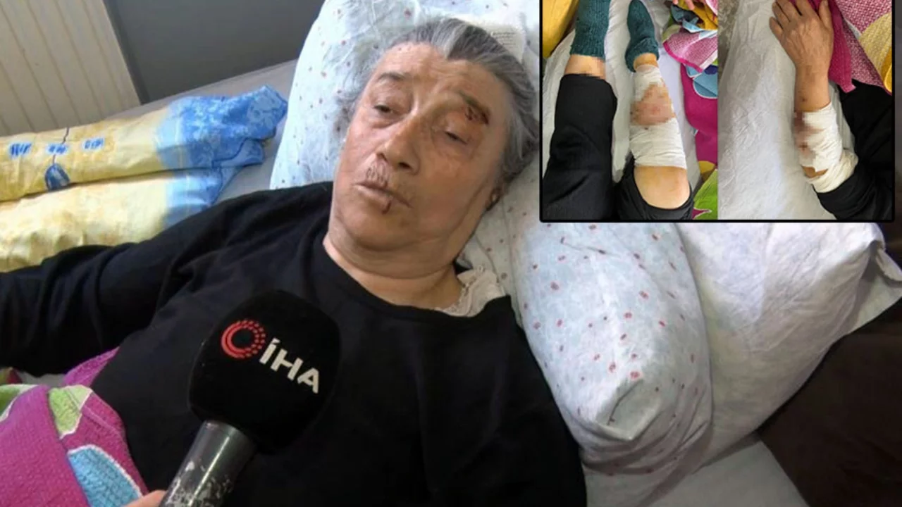 Köpek sürüsünün saldırısında ağır yaralanan yaşlı kadın: "Kolumu, elimi, başımı ve bacağımı parçaladılar"