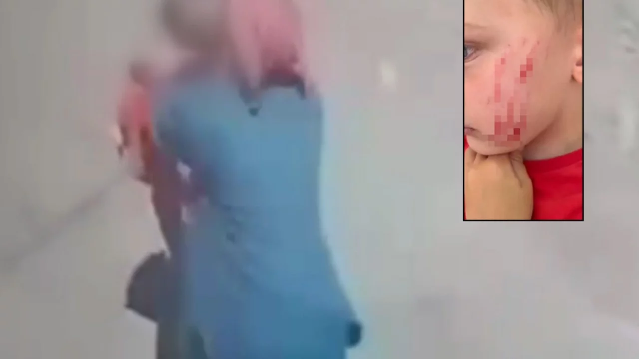 Oyun Oynayan 4 Yaşındaki Çocuğa Saldırı Kamerada