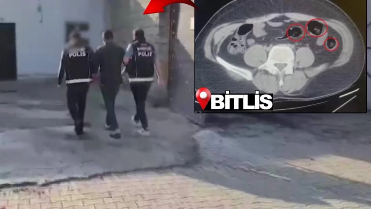 Mide ve bağırsaklarında uyuşturucu taşıyan şüpheli yakalandı